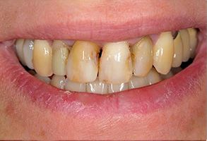 John G. Fletcher, DMD | Cosmetic Dentistry, Snoring Appliances and Clear Aligner Orthodontics
