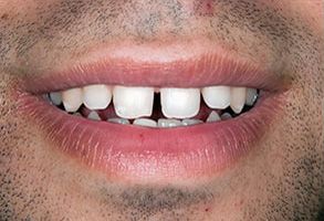 John G. Fletcher, DMD | Cosmetic Dentistry, Dentures and Night Guards